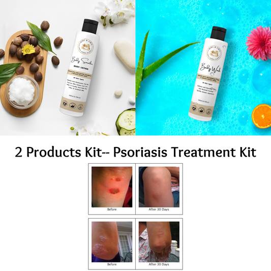 Psoriasis Treatment Kit